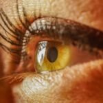 eye flu
